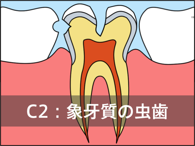 C2